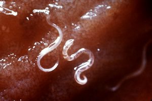damage from hookworms in humans